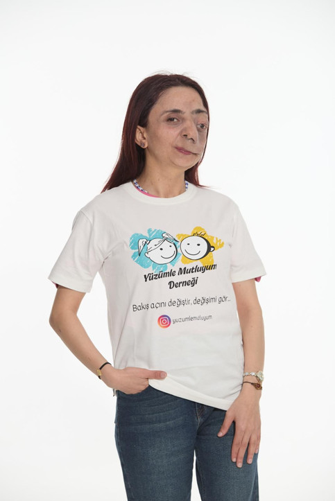 Gizlemeyi değil mücadeleyi seçtiler