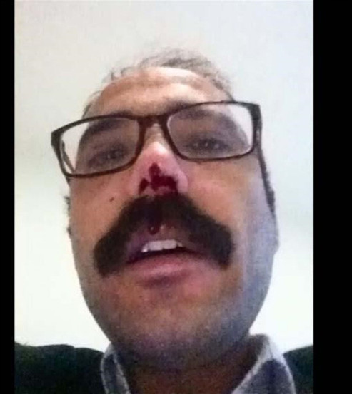 Adliyede avukata öldüresiye dayak