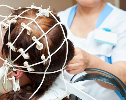 İnsan hafızası silinebilir mi