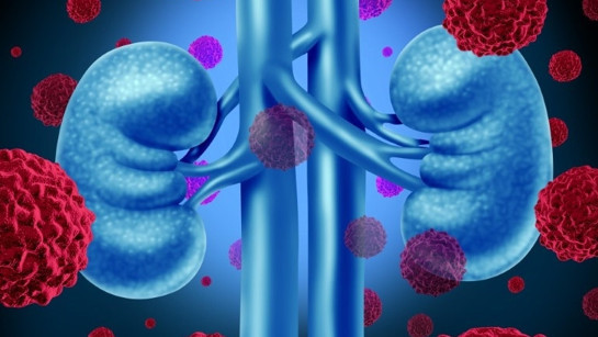 Üre nedir? Üre kan değeri kaç olmalıdır? Düşüklüğü ile yükseliği nedenleri ve belirtileri