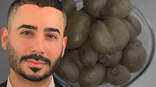 Ünlü doktor uyardı: O meyveyi yerken çok büyük bir hata yapıyorsunuz!