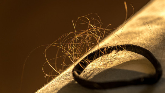 Saç dökülmesine ‘mevsimsel’ deyip geçmeyin! Çoğumuz bunu yaşıyoruz ama sebebini bilmiyoruz... İşte türleri ve tedavi yöntemleri