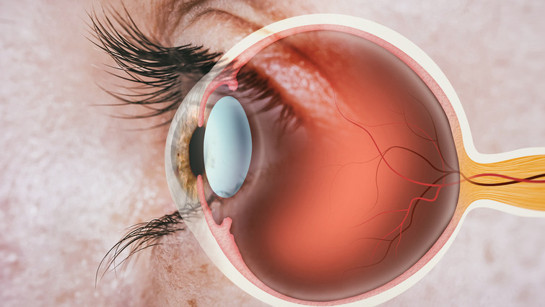 Tıp tarihinde bir ilk! Retinal nakil yapıldı, yıllar sonra yeniden görmeye başladı