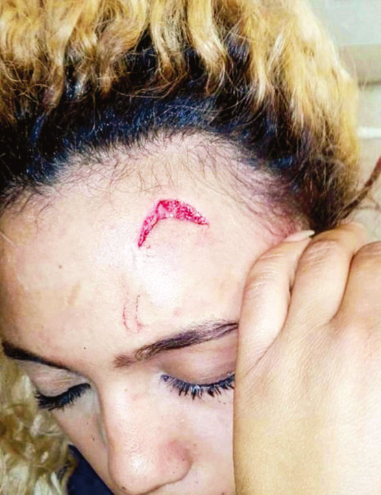 First Lady beni kabloyla dövdü