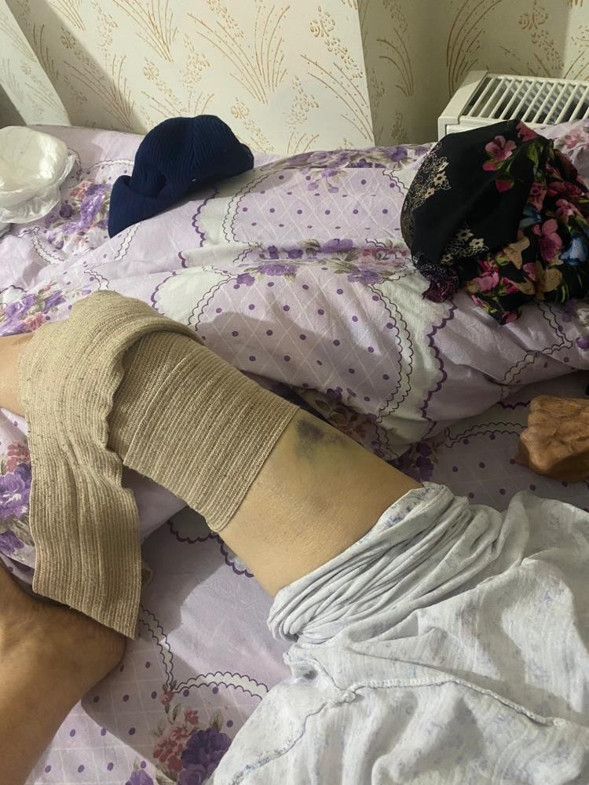 Ankarada bakıcı dehşeti 91 yaşındaki kadın kâbusu yaşadı