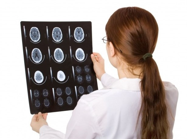 Epilepsi Nedir & Nasıl Tedavi Edilir