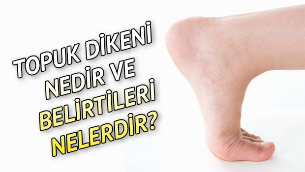Topuk dikeni nedir? Topuk dikeni belirtileri nelerdir?