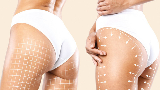 Estetik Plastik Cerrahi Uzmanı Op. Dr. Bülent Cihantimur: Genital güzelleştirme ve yağ transferi