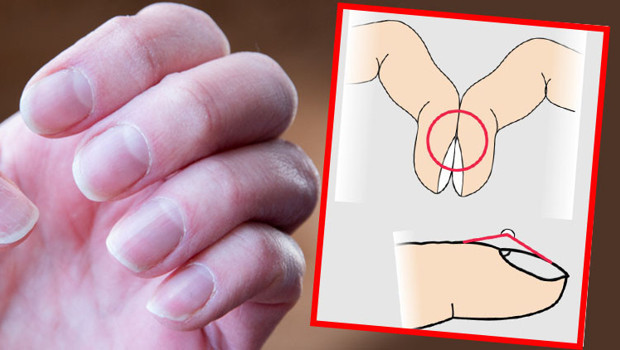 Ölümcül hastalığın sessiz işareti: Parmaklarda görülen bu değişikliğe dikkat Basit bir testle anlamak mümkün… Ölümcül hastalığın sessiz işareti: Parmaklarda görülen bu değişikliğe dikkat Basit bir testle anlamak mümkün…