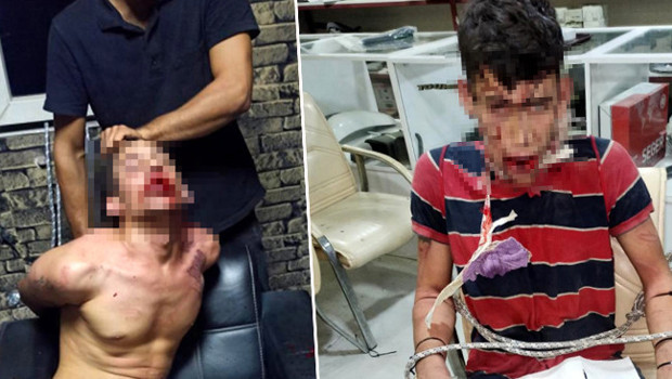 3 gün boyunca böcek yedirip, dişlerini kırdılar! İstenen ceza belli oldu | 'Sabaha kadar işkenceye maruz kaldım'