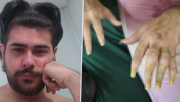 3 yıldır evden dışarı çıkmıyor, tırnaklarını kesmiyordu! Eski hali ortaya çıktı | Arkadaşı Barış'ın değişimini anlattı