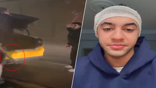 Tartışmaya girdiği taksicisi, motosiklet sürücüsünü sopayla yaraladı