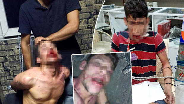 3 gün süren kâbus: Hamam böceği yedirildi, darbedildi, dişleri kırıldı! İşkence davasında karar