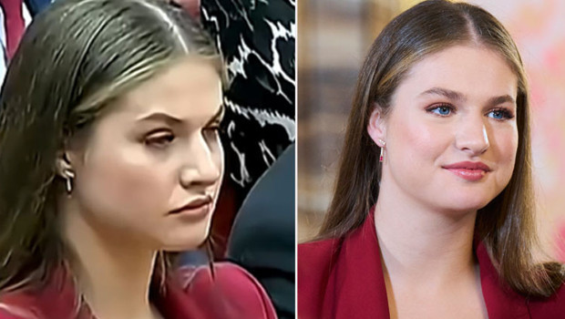 Güzel gözlerini açık tutamadı: Gizli hastalığı ifşa oldu