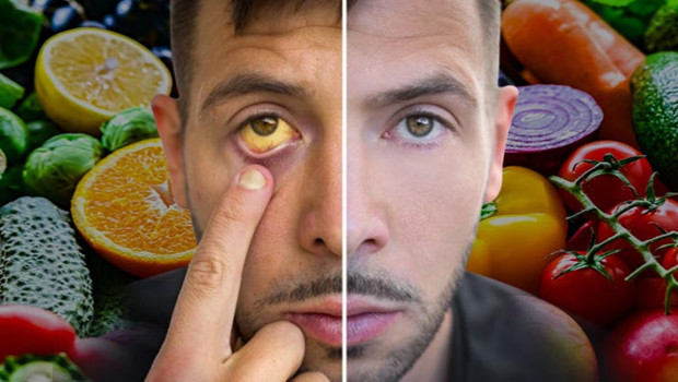 Dikkat: Bu besinler cildinizin rengini değiştiriyor! Hangi yiyecekler hangi renkleri veriyor?