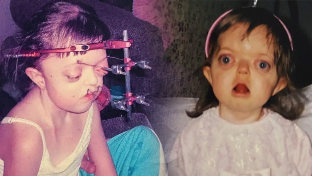 Nadir bir genetik durumla doğdu, doktorlarını bile şaşırttı... Yıllarca meraklı bakışlara maruz kaldı! Nasıl başardığını anlattı