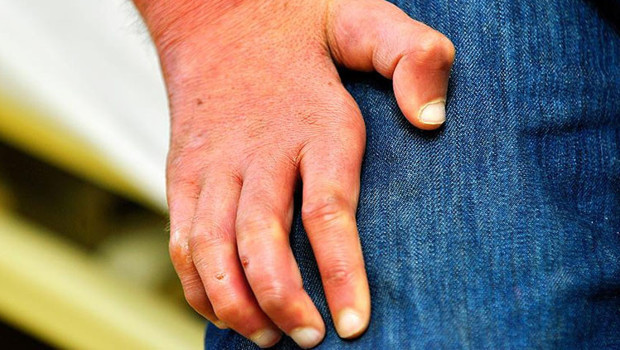 Avrupa alarmda! Tarihin en eski bulaşıcı hastalığı geri döndü