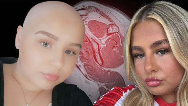 Omzundaki ağrı için doktor aylarca 'kas zorlanması' dedi, gerçek çok sonra ortaya çıktı: 'Kulaklarıma inanamadım, daha 16 yaşındaydım'