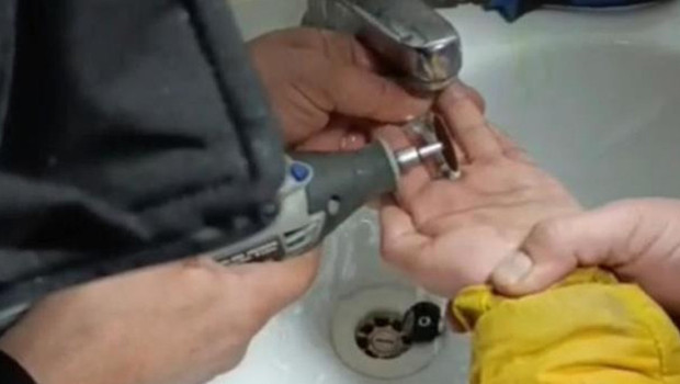 Parmağına Metal Para Sıkışan Çocuğun Kurtuluşu İnanılmazdı!