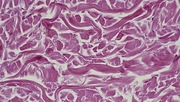 Bilim insanları yaşlı hücreleri gençleştirmenin yolunu bulmuş olabilir