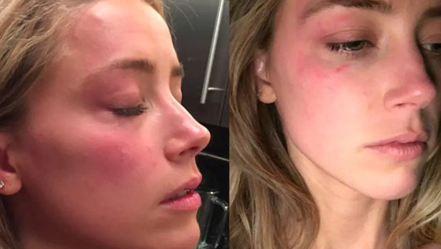 Büyük aşkla evlendiği kocasından şiddet görünce boşanmıştı... 'Konuşma yeteneğimi kaybettim... Hikayemi anlatmak istemiyorum'