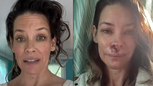 Ünlü oyuncu emekliliğin keyfini bile süremedi... 'Beyin sarsıntısı geçirdim... İyileşmek için çok para harcadım'