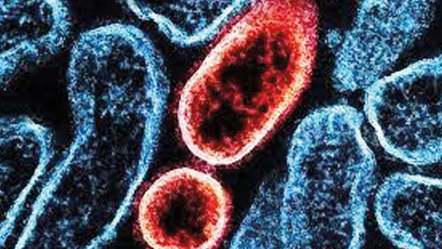 ‘Nipah pandemisi’ kapıda mı... 27 yıllık virüste salgın endişesi