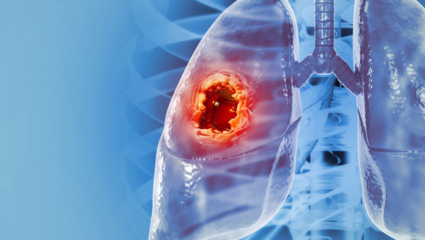 Her yıl 2 milyona yakın insan bu yüzden ölüyor! Risk faktörleri ve en yaygın belirtileri neler?