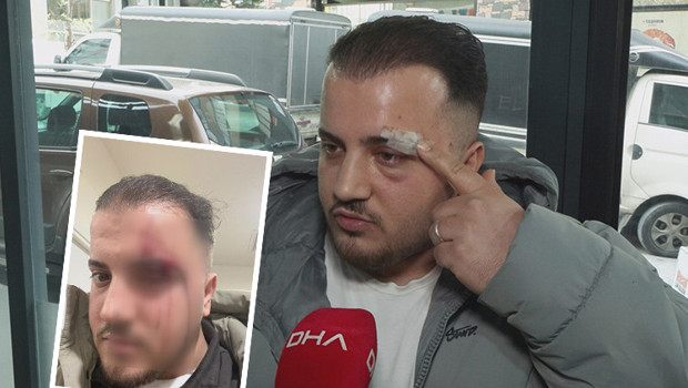İstanbul'da akılalmaz olay! Dövdüğü adamı ATM'de tanımazlıktan geldi: Buyur kardeşim