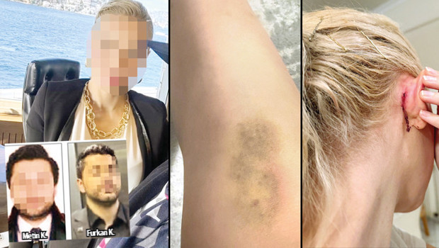 Ünlülerin avukatına saldırdılar