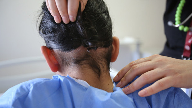 Hatay'da 14 yaşındaki çocuğun karnından 3 kilogramlık saç yumağı çıktı