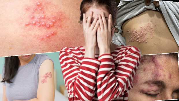 Gençleri hedef alıyor: Ölümcül olabiliyor! ‘Derime kaynar su dökülmüş gibiydi’, ‘Eve kapandım, dışarı çıkamadım’