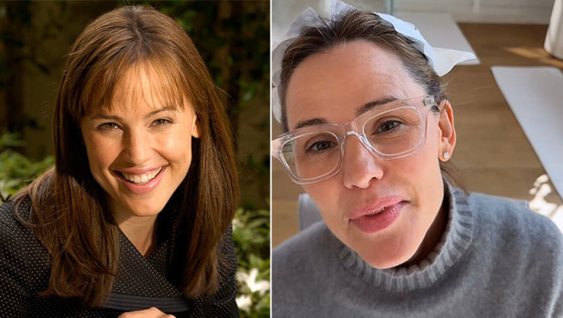 Estetik iddialarını sonunda cevapladı… Üç çocuğu ona yalvarmış: Anne ne olur yüzüne dokunma!