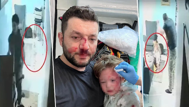 14 aylık İkra ile babasının darbedilmesine ilişkin iddianame hazırlandı! Çocuk skuter'ı 'silah' olarak sayıldı... İşte istenen ceza