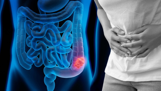 Bilim insanları yeni bir tedavi keşfetti! Gençler arasında yayılmaya başlamıştı... O kanser tarih mi oluyor?