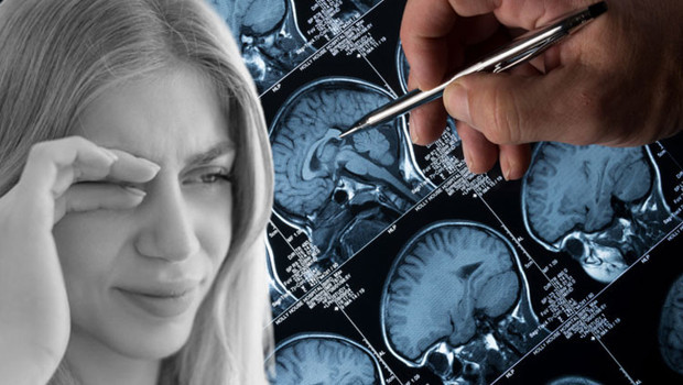 Görme sorununu makyajdan sandı, gerçek çok ağır çıktı! 15 yıllık doğum kontrol iğnesi sonrası tümör alarmı