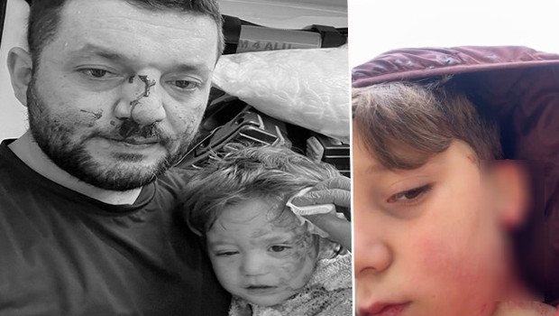 Yalova'da Bebeğiyle Darbedilen Babanın Oğluna Taşlı Saldırı!