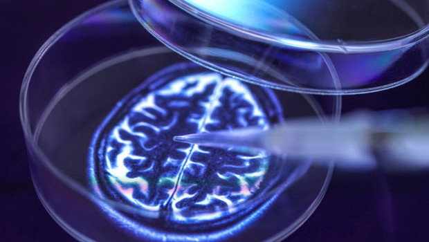 Alzheimer sonunda tarih mi oluyor? Hafıza sorunları başlamadan önce sinyal verebilen test geliştirildi