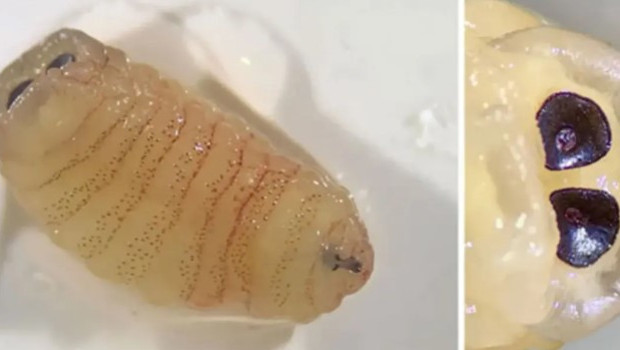 Hapşırınca burnundan çıktı: Yüzüne üşüşen sinekler haftalar sonra dehşete dönüştü