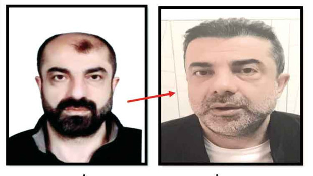 Azmettirici ameliyatla yüzünü değiştirmiş