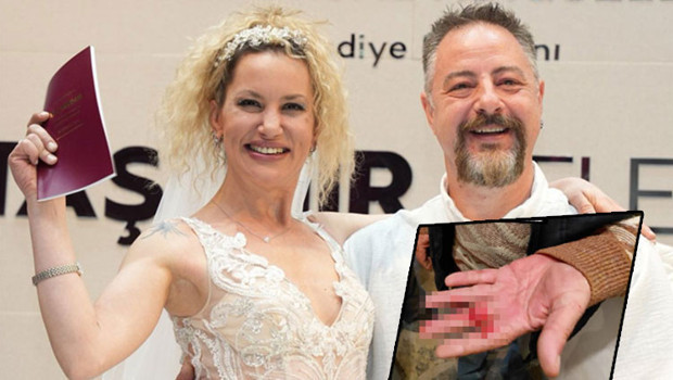 Yıldız Asyalı'nın büyük çaresizliği... 'Babam da eşim tarafından darp edildi'