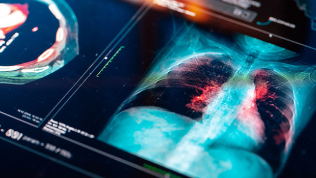 Akciğerde çığır açan keşif: Hücrelerin ‘onarım düğmesi’ bulundu! ‘Süreci tersine çevirebilme potansiyeli taşıyor'