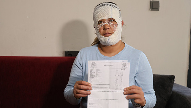 'Prenses' paketini seçti, dehşeti yaşadı: Çocuğum beni gördü, 'öcü' diyerek kaçtı