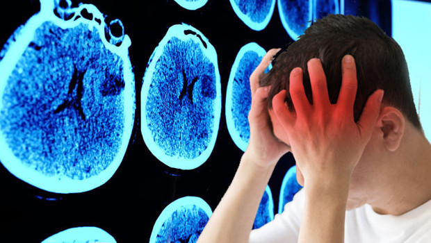 Baş ağrısı ve unutkanlığı hafife almayın! Altından bir tümör çıkabilir