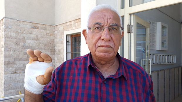 Asansördeki sorudan sonra saldırdı: Gözü dönmüş adam komşusunun parmağını ısırıp kopardı