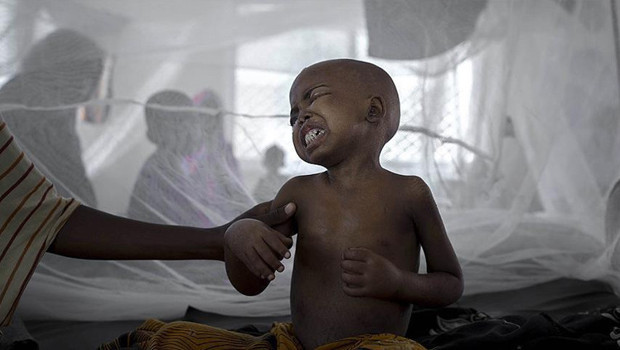Afrika ülkesinde kolera alarmı: Acil tedbirler devreye alındı