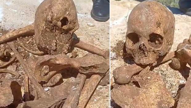 Malatya'da temel kazısında insan kemikleri ile kafatası parçası bulundu