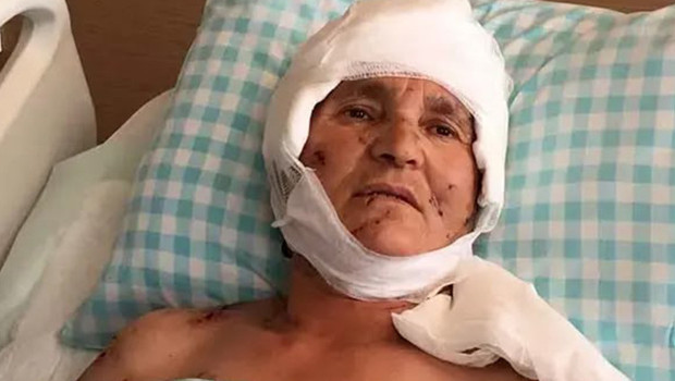 Yargıtay'dan köpek saldırısı kararı: Malul kalan kadına 637 bin lira tazminat haber görseli