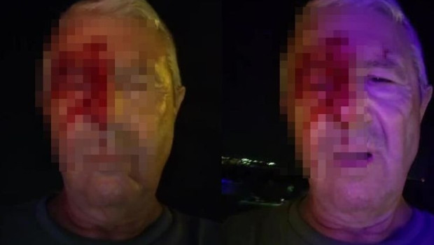 Haber yaparken saldırıya uğrayan muhabir yaralandı haber görseli