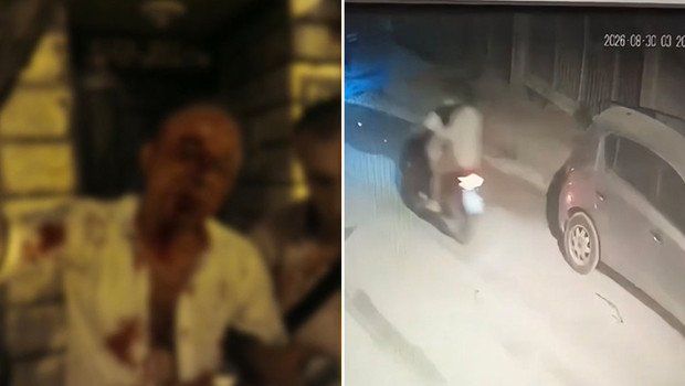 Sokak ortasında 'yan bakma' kavgası! Kanlar içinde konuştu: Her şeyim patladı